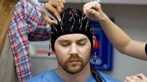 Российские ученые нашли новый метод борьбы с эпилепсией