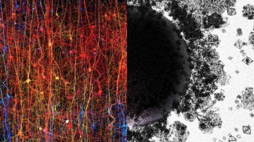 Многомерная структура: учёные нашли в мозгу 11 измерений